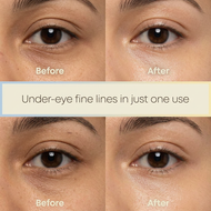 Ever-Youth dual effect eye cream